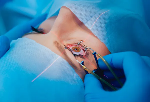 Cirurgia Refrativa - Rio de Janeiro // Clínica - Oftalmologia RJ Cirurgia Refrativa - Rio de Janeiro // Clínica - Oftalmologia RJ